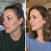 Vitamin C Hyaluronic Acid Brightening Serum