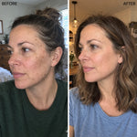 Vitamin C Hyaluronic Acid Brightening Serum