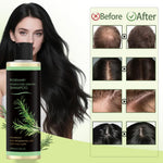 Rosemary Hair Growth Set with Keratin